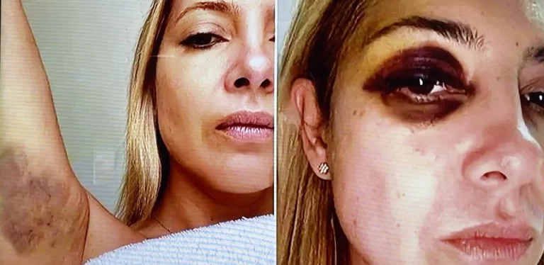 Filtraron fotos de Fabiola golpeada y chats reveladores