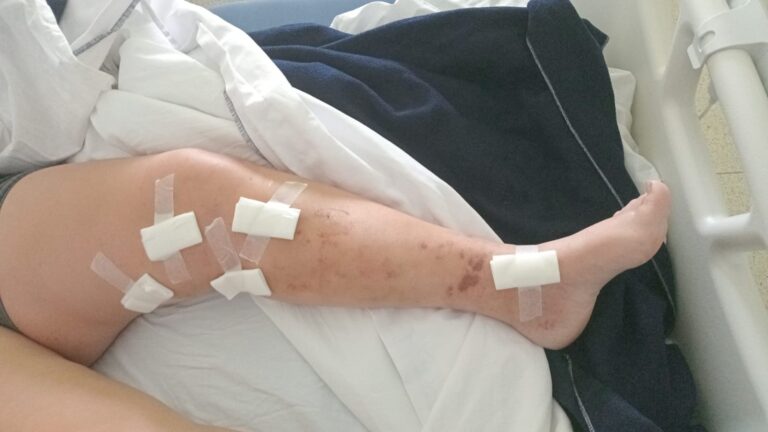 María Eugenia Necesita Nuestra Ayuda para Seguir Luchando