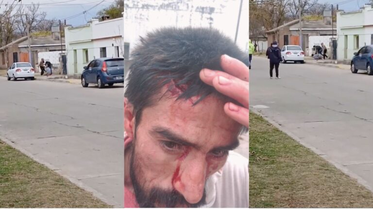 Video sensible: Brutal agresión a un hombre discapacitado en Justo Daract