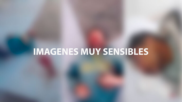 Robó, fue golpeado, lo atendieron y volvió a delinquir tras el alta médica