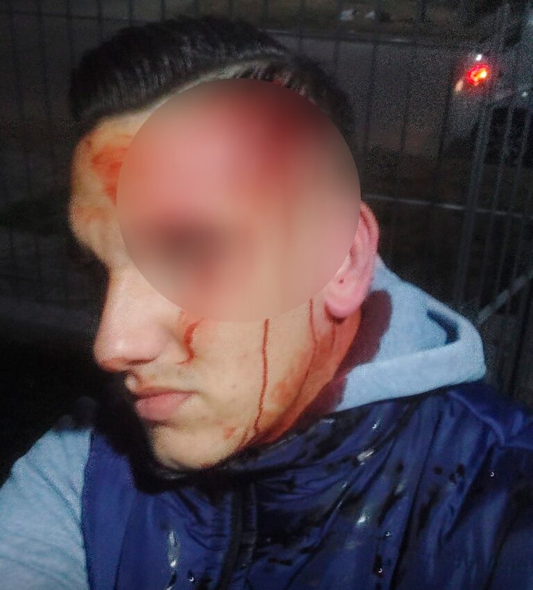 “Me atacaron con un fierro”: violenta agresión a un hombre en Villa Mercedes